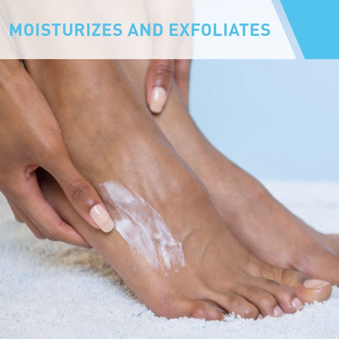 CERAVE - Sa Renewing Foot Cream - KERATOSIS PILARIS/ PSORIASIS PRONE SKIN - LUXURIUM