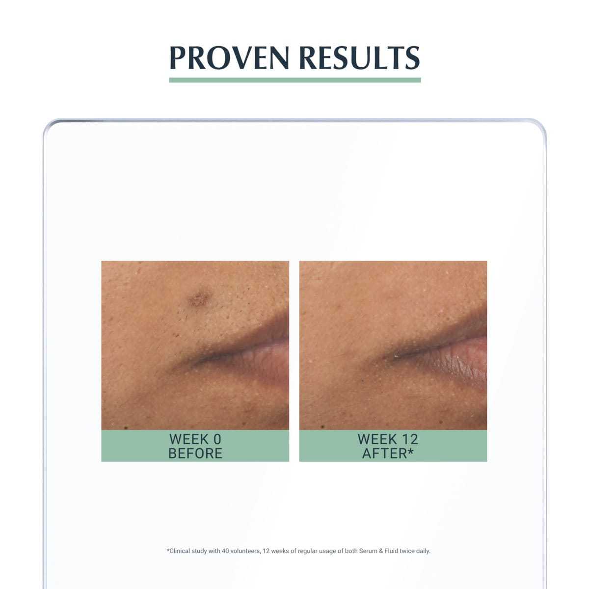 Eucerin - DermoPurifyer Triple Effect Serum - Skincare - LUXURIUM